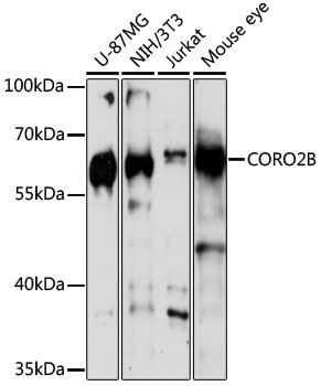 CORO2B Antibody