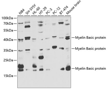 Myelin Basic protein Antibody