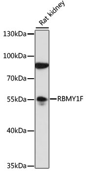 RBMY1F Antibody