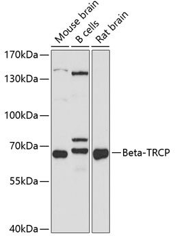 Beta-TRCP Antibody