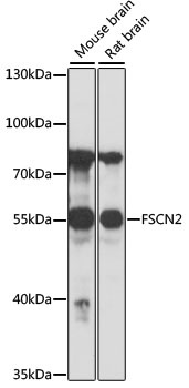 FSCN2 Antibody