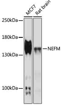 NEFM Antibody