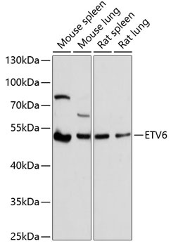 ETV6 Antibody