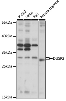 DUSP2 Antibody