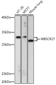 WBSCR27 Antibody