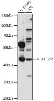 NFATC2IP Antibody