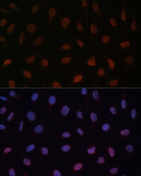 MED25 Antibody