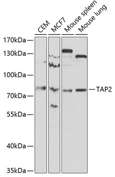 TAP2 Antibody