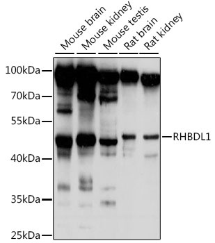 RHBDL1 Antibody