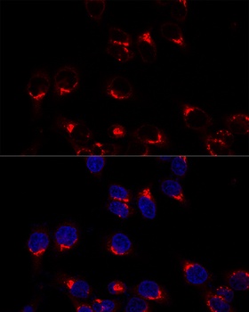 USO1 Antibody