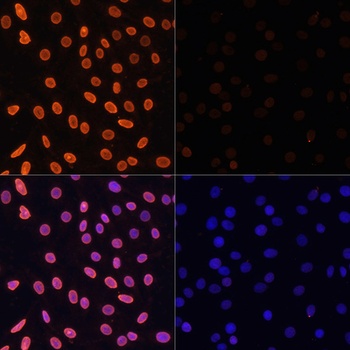 H3K36ac Antibody