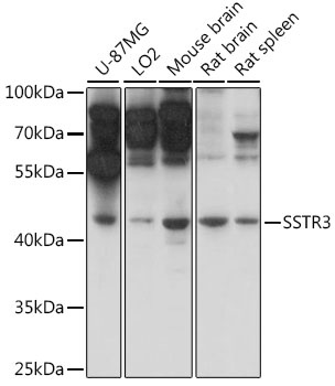SSTR3 Antibody