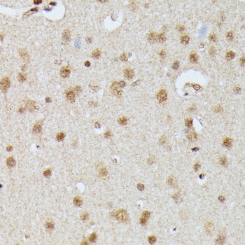 IGHMBP2 Antibody