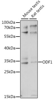 ODF1 Antibody