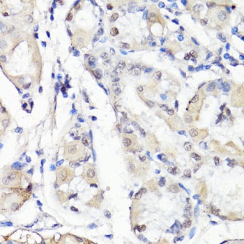 TBX20 Antibody