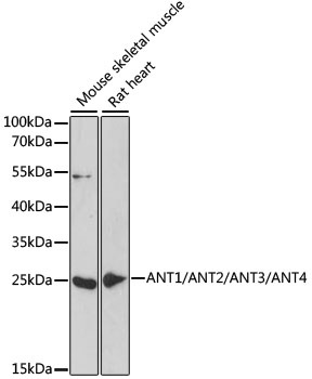 ANT1/ANT2/ANT3/ANT4 Antibody