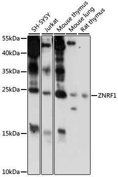 ZNRF1 Antibody