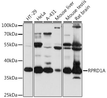 RPRD1A Antibody