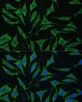 TIMM8B Antibody