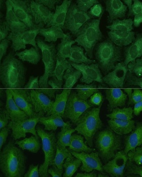 TIMM8B Antibody
