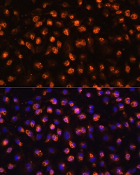 ITGAM Antibody