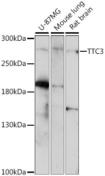 TTC3 Antibody