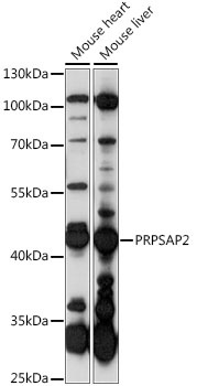 PRPSAP2 Antibody