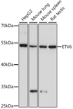 ETV6 Antibody