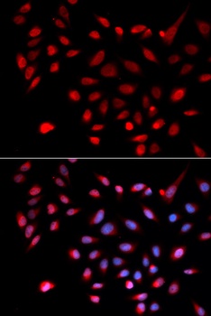 CDK9 Antibody