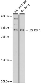 p27 KIP 1 Antibody