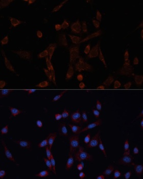 CANX Antibody