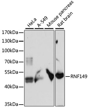 RNF149 Antibody