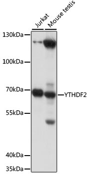 YTHDF2 Antibody