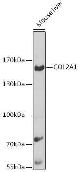 COL2A1 Antibody