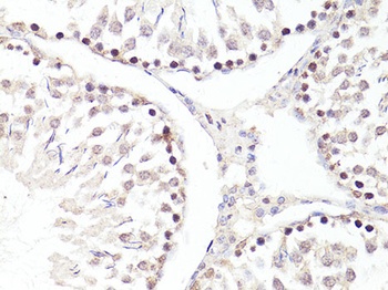 TWIST1 Antibody