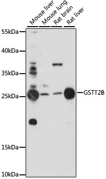 GSTT2B Antibody