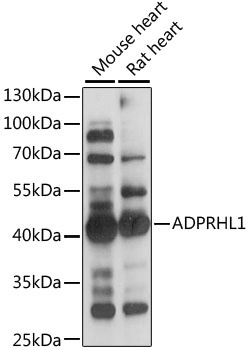 ADPRHL1 Antibody