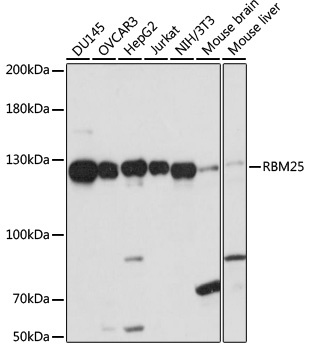 RBM25 Antibody