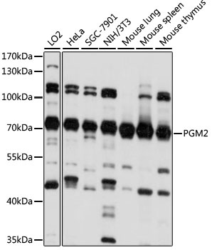 PGM2 Antibody