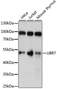 UBR7 Antibody