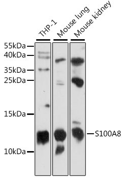 S100A8 Antibody