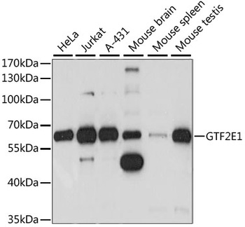 GTF2E1 Antibody