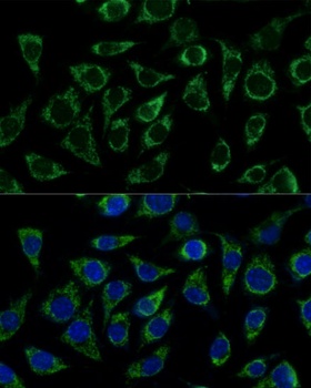 ATP5C1 Antibody