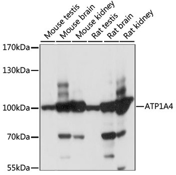ATP1A4 Antibody