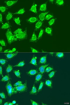 MCCC2 Antibody