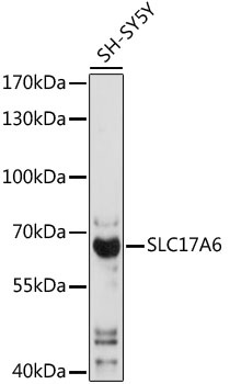 SLC17A6 Antibody