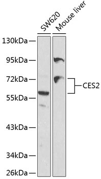 CES2 Antibody