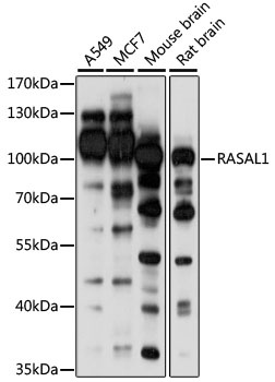 RASAL1 Antibody