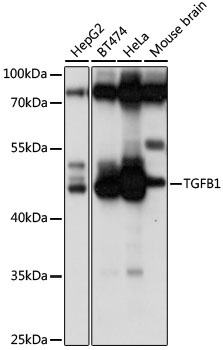 TGFB1 Antibody