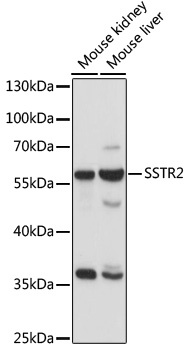 SSTR2 Antibody